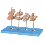 Human Teeth Model, Dentition Development