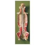 Spinal Cord in the Spinal Canal Model