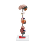 Human Hypertension Model, 6 Parts