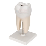 Human Teeth Model, Lower Molar with One Root