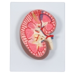 Human Kidney Model